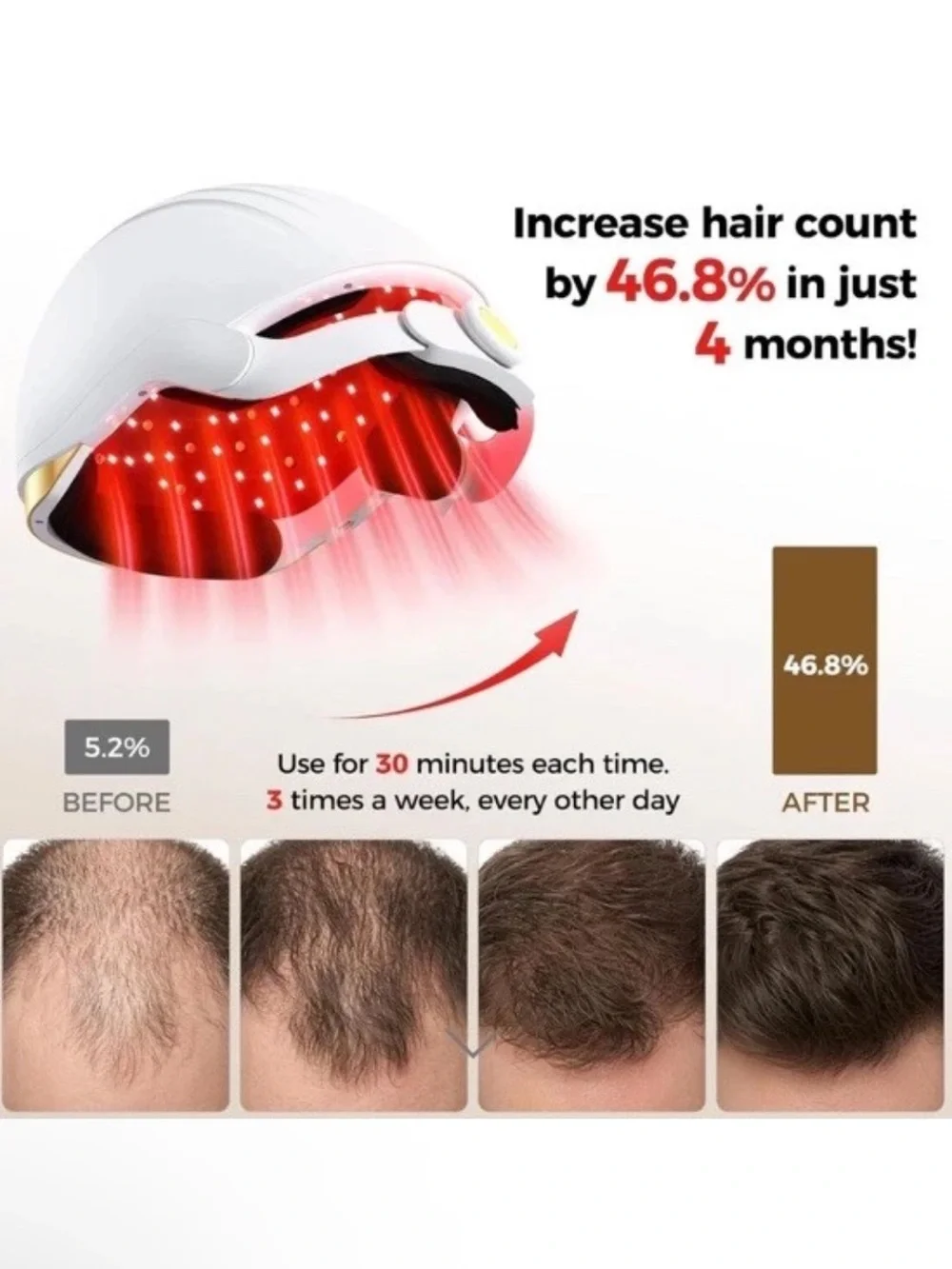 VICONOR Infrared Red Light Therapy Cap Hair Growth 272 Laser & LEDs Thicker Hair